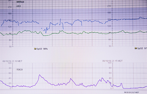 how to read heart monitors a